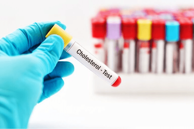 An image of a vial saying 'Cholesterol - Test', emphasising the importance of looking for the warning signs of high cholesterol 